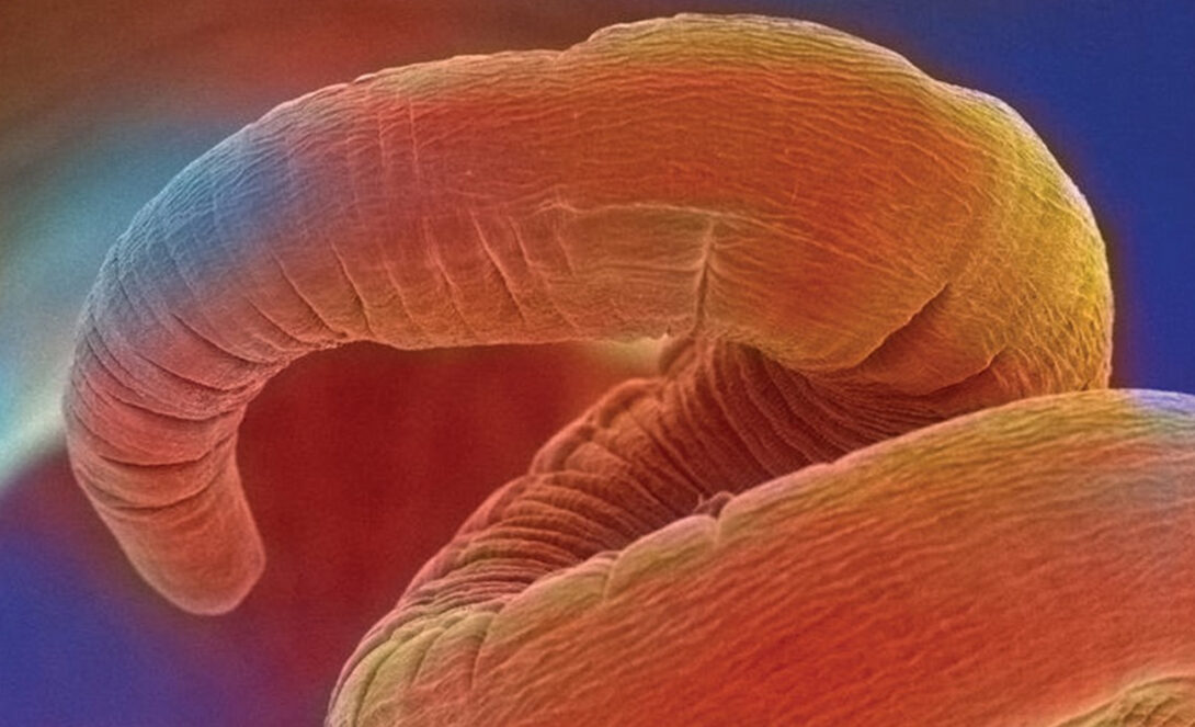 colorful image of a microscopic worm coiled up