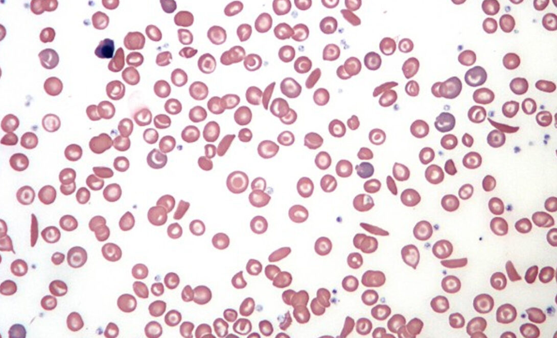 many small red blood cells against a white background