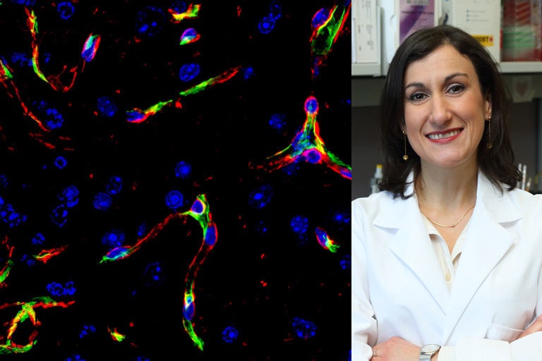 at left a photo of a woman with shoulder-length dark hair, wearing a white lab coat and standing in a laboratory, at right a colorful micrograph of endothelial cells and basement membrane